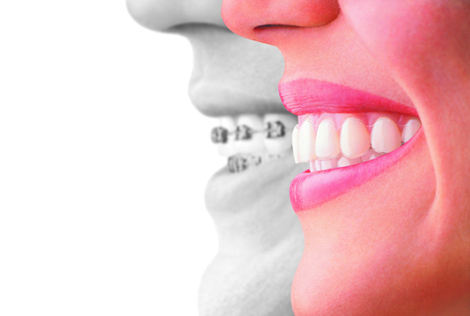 orthodontics in profile